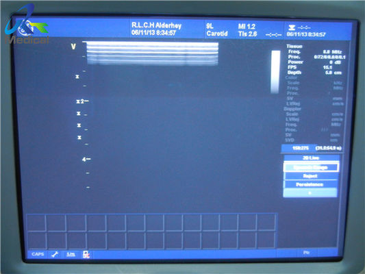 Linear Array Used Ultrasound Probe Vivid 7 60 days warranty