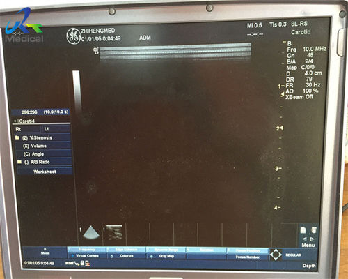 10.0MHz Ultrasound Scanner Probe GE 8L-RS Linear Versatile Pediatric Abdomen Medical Service
