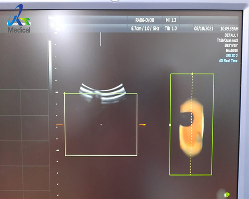 3D Ultrasound Probe Repair GE RAB-6-D Transducer Abnormal Image With Air Bubble