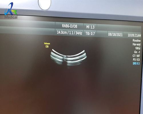 3D Ultrasound Probe Repair GE RAB-6-D Transducer Abnormal Image With Air Bubble
