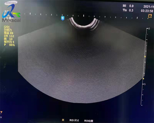 Samsung ER4-9 Ultrasound Probe Repair Replace Lens
