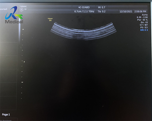 Replace Lens Ultrasound Probe Repair GE 4C-D Strain Relief